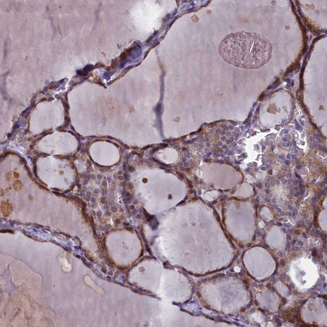 ARL15 Antibody in Immunohistochemistry (Paraffin) (IHC (P))