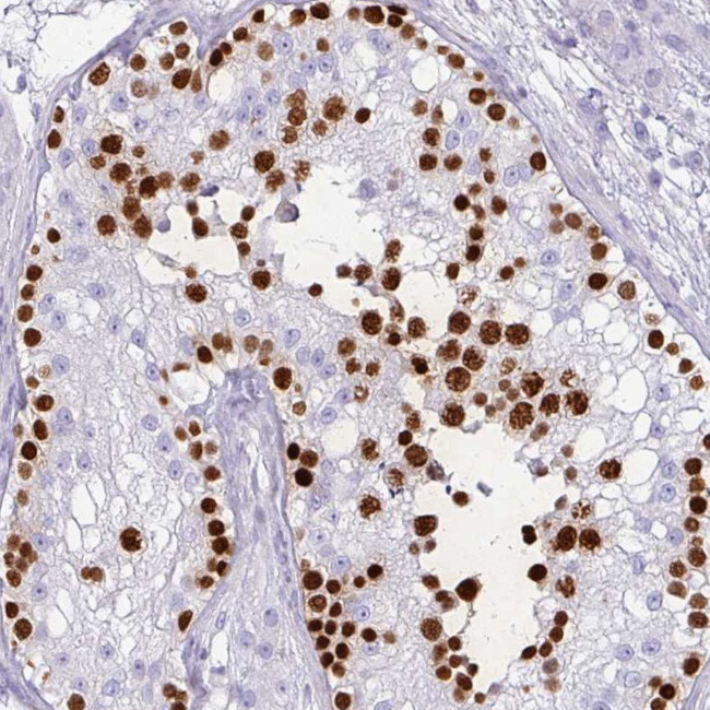 VCX2 Antibody in Immunohistochemistry (Paraffin) (IHC (P))