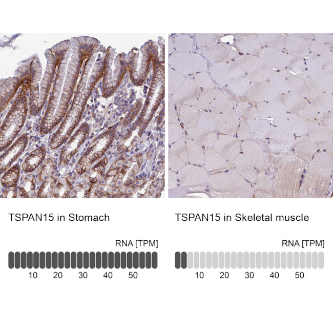 TSPAN15 Antibody