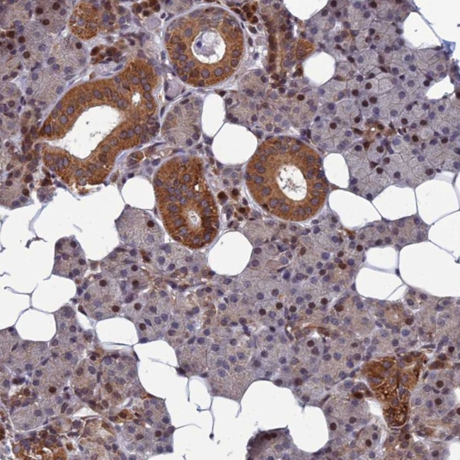 CCDC160 Antibody in Immunohistochemistry (Paraffin) (IHC (P))