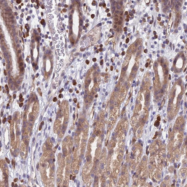 PPP1R26 Antibody in Immunohistochemistry (Paraffin) (IHC (P))