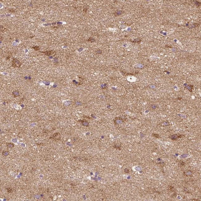 SGTB Antibody in Immunohistochemistry (Paraffin) (IHC (P))