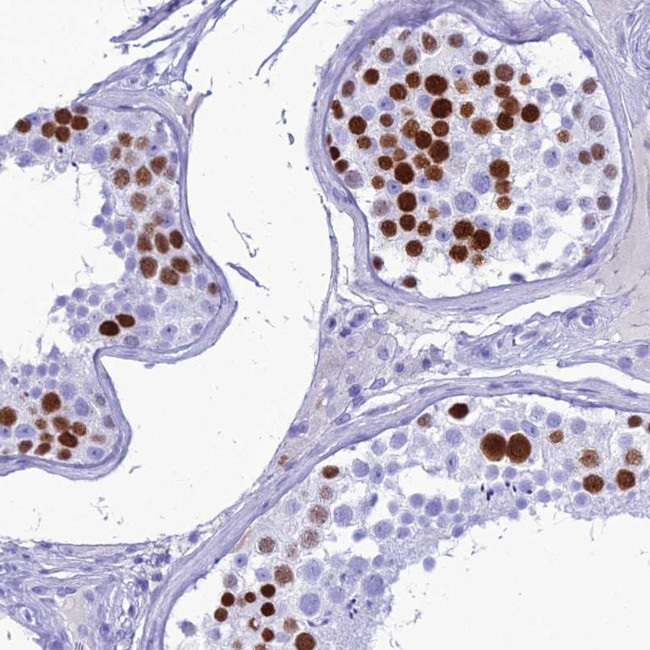 PNMA5 Antibody in Immunohistochemistry (Paraffin) (IHC (P))