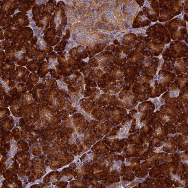 RNaseK Antibody in Immunohistochemistry (Paraffin) (IHC (P))