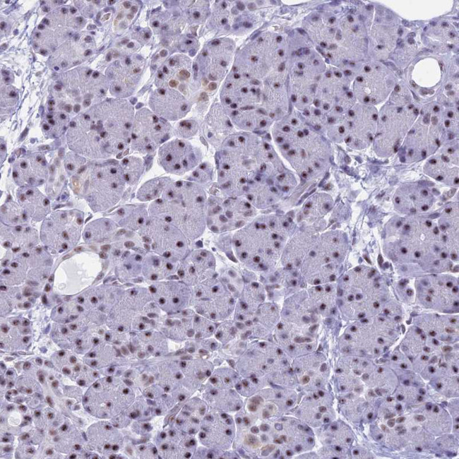 KLF14 Antibody in Immunohistochemistry (Paraffin) (IHC (P))
