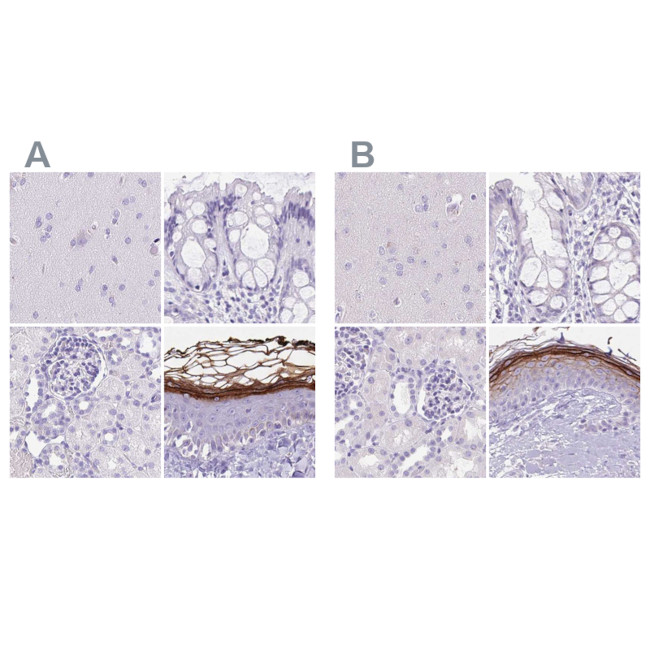 CDSN Antibody in Immunohistochemistry (IHC)