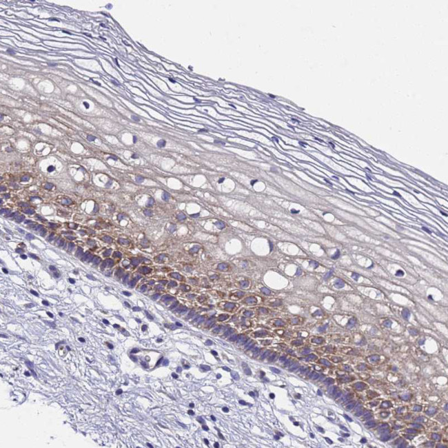 DCAF12L2 Antibody in Immunohistochemistry (Paraffin) (IHC (P))