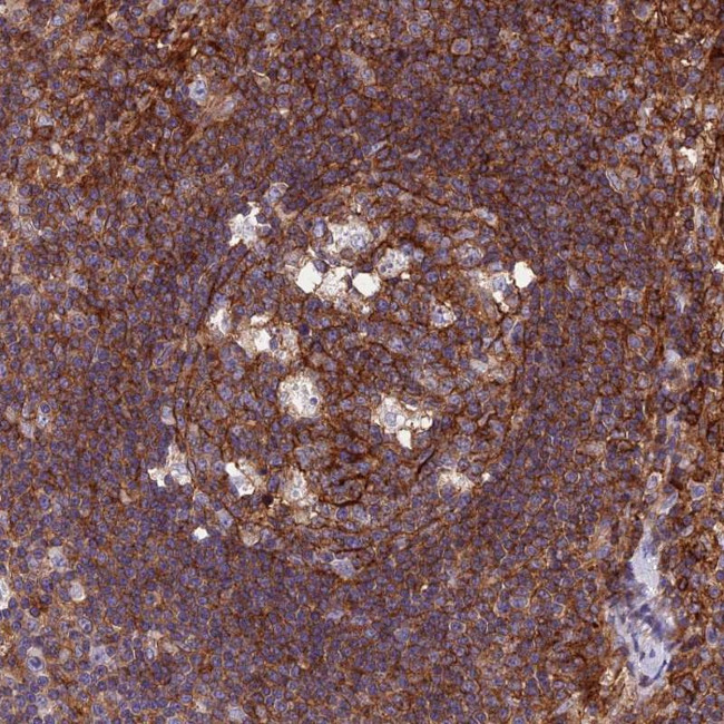 PPP1R18 Antibody in Immunohistochemistry (Paraffin) (IHC (P))