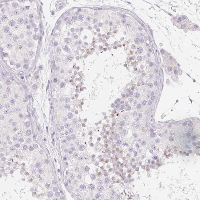 SPACA5 Antibody in Immunohistochemistry (Paraffin) (IHC (P))