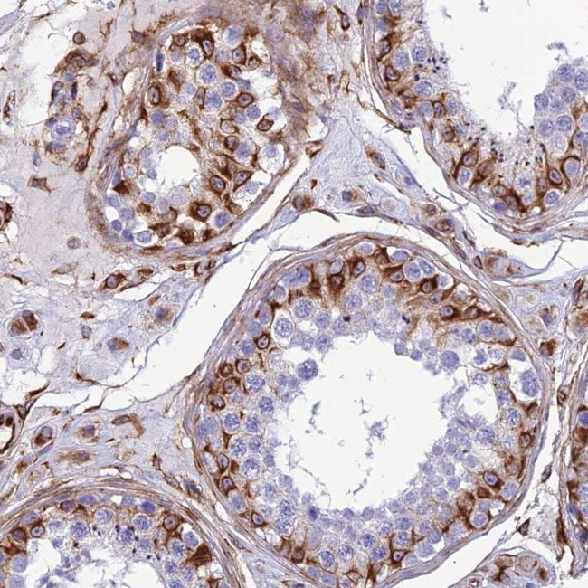 FBXL20 Antibody in Immunohistochemistry (Paraffin) (IHC (P))