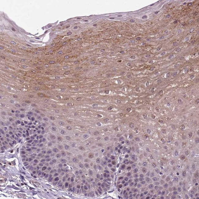 TPRG1 Antibody in Immunohistochemistry (Paraffin) (IHC (P))