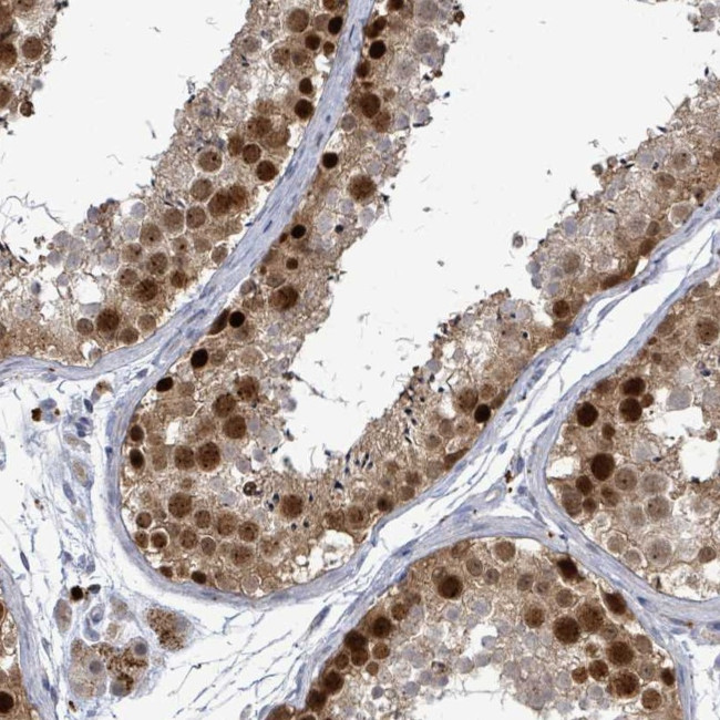 CT45A Antibody in Immunohistochemistry (Paraffin) (IHC (P))