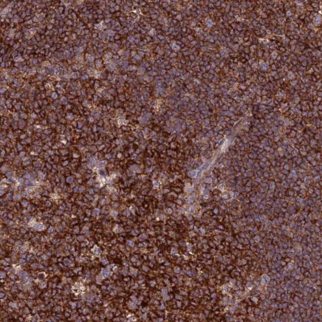 FAM76A Antibody in Immunohistochemistry (Paraffin) (IHC (P))