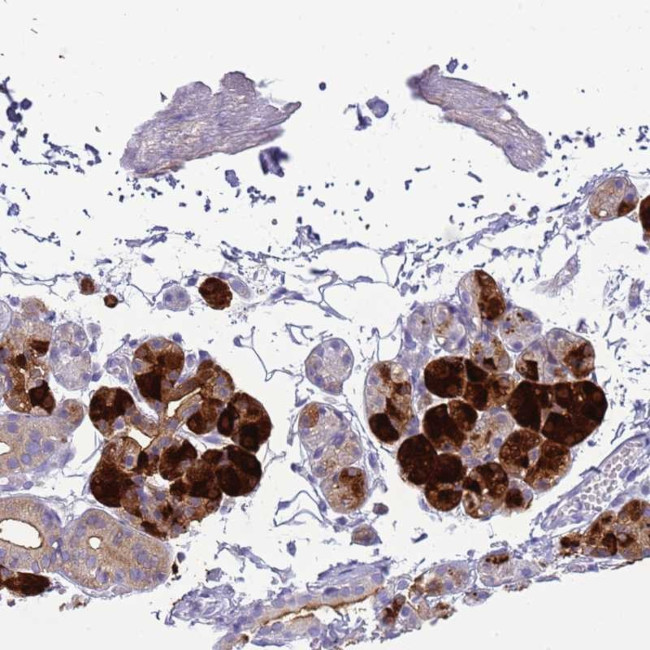 Cystatin S Antibody in Immunohistochemistry (Paraffin) (IHC (P))