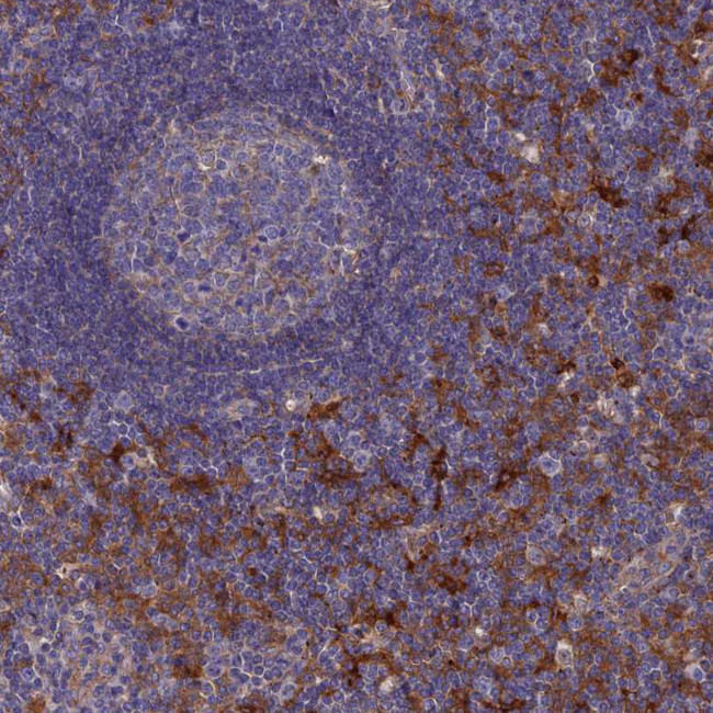 SNX11 Antibody in Immunohistochemistry (IHC)