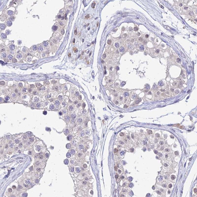 C6orf163 Antibody in Immunohistochemistry (Paraffin) (IHC (P))