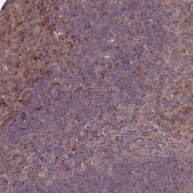 MFSD8 Antibody in Immunohistochemistry (Paraffin) (IHC (P))