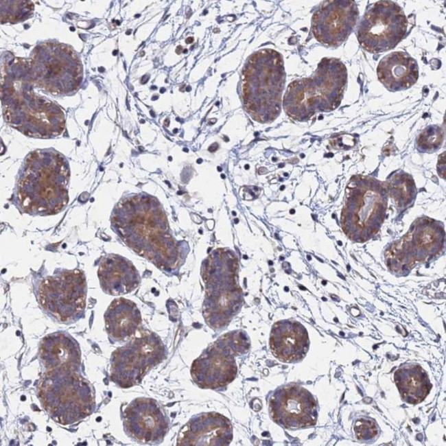 FAM25A Antibody in Immunohistochemistry (IHC)