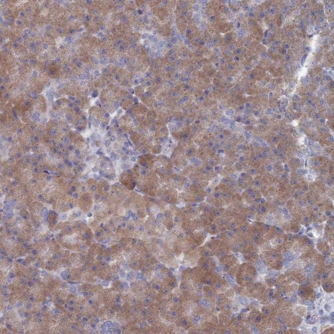 TMEM128 Antibody in Immunohistochemistry (IHC)