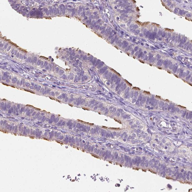 CATIP Antibody in Immunohistochemistry (Paraffin) (IHC (P))