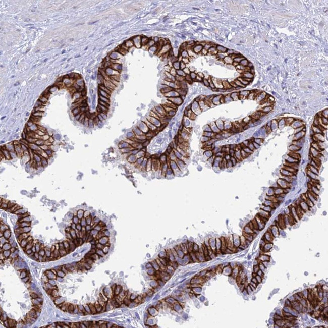OR1Q1 Antibody in Immunohistochemistry (Paraffin) (IHC (P))