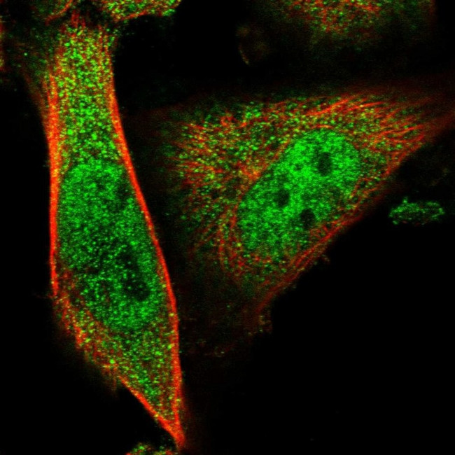 MYEOV2 Antibody in Immunocytochemistry (ICC/IF)