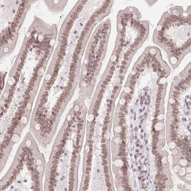 ZNF488 Antibody in Immunohistochemistry (Paraffin) (IHC (P))