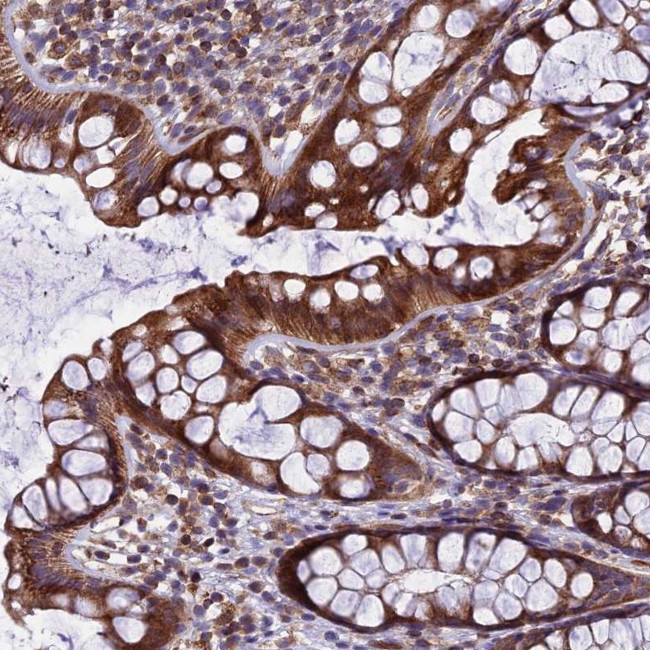 GIMAP1 Antibody in Immunohistochemistry (Paraffin) (IHC (P))
