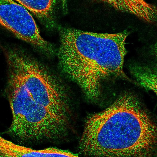 TMEM2 Antibody in Immunocytochemistry (ICC/IF)