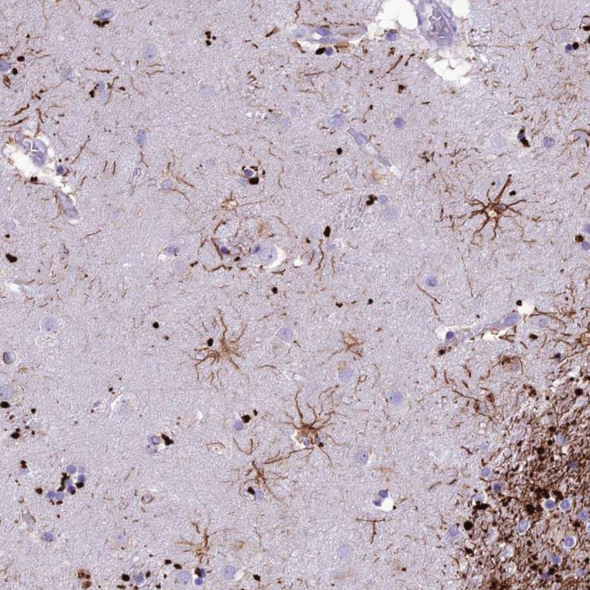 IFT172 Antibody in Immunohistochemistry (Paraffin) (IHC (P))