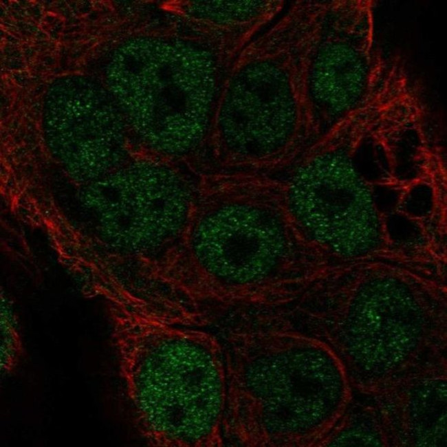 TOR4A Antibody in Immunocytochemistry (ICC/IF)