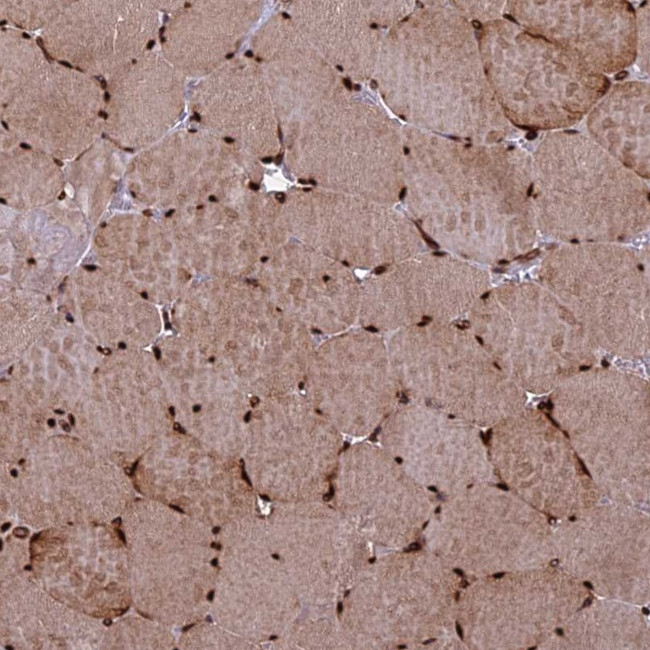 TCEA3 Antibody in Immunohistochemistry (Paraffin) (IHC (P))