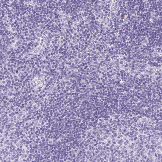 Cystatin M Antibody in Immunohistochemistry (Paraffin) (IHC (P))