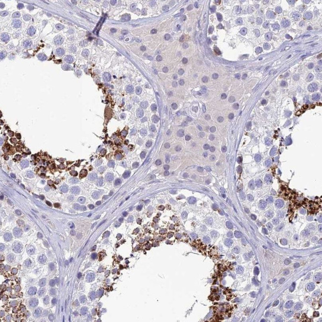 GOLGA6A Antibody in Immunohistochemistry (IHC)