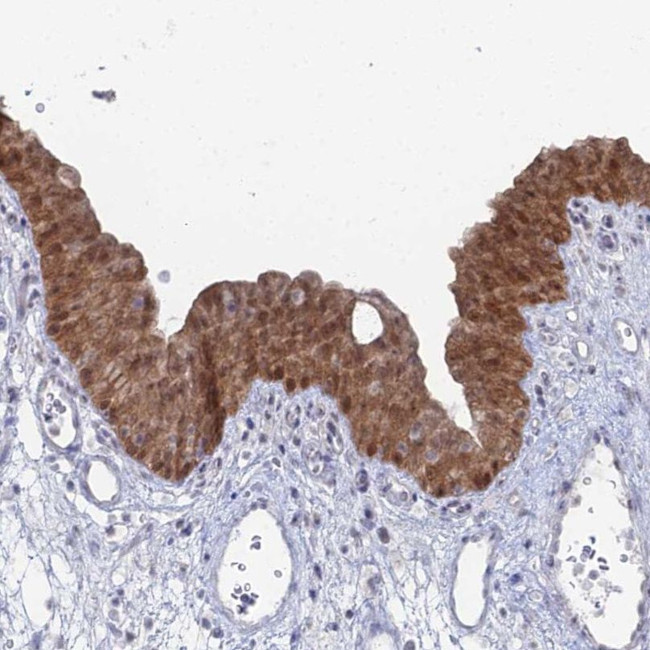 THAP4 Antibody in Immunohistochemistry (IHC)