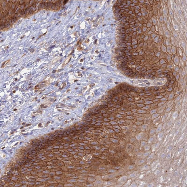 OR5T3 Antibody in Immunohistochemistry (Paraffin) (IHC (P))