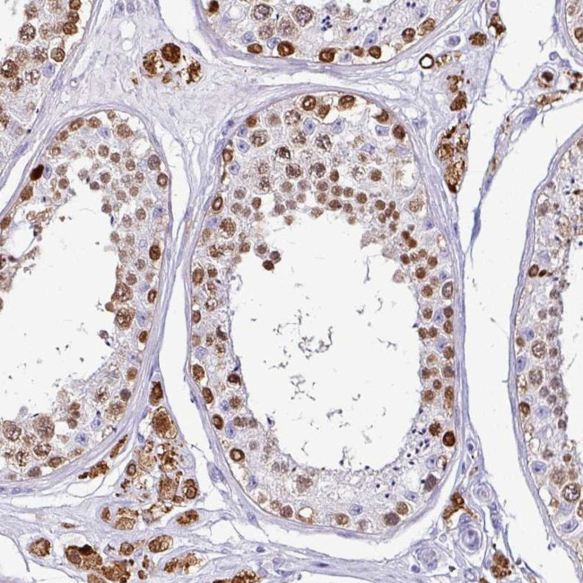 VCY1B Antibody in Immunohistochemistry (Paraffin) (IHC (P))