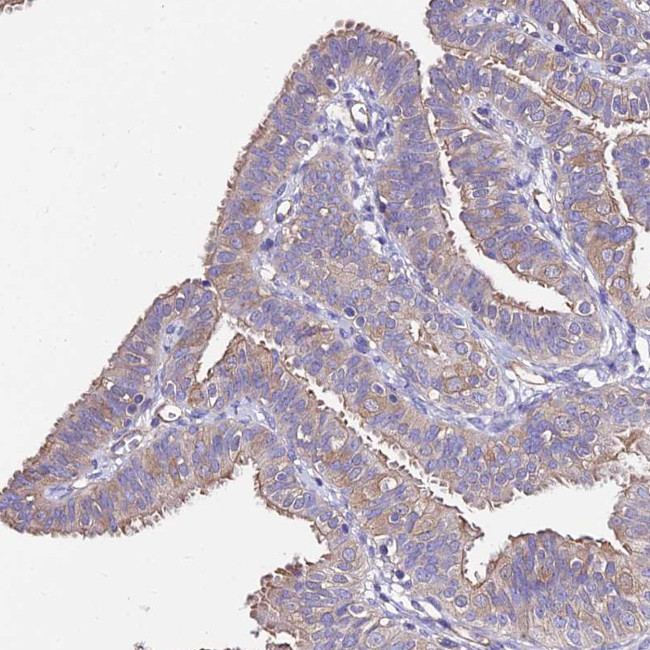 CALML3 Antibody in Immunohistochemistry (Paraffin) (IHC (P))