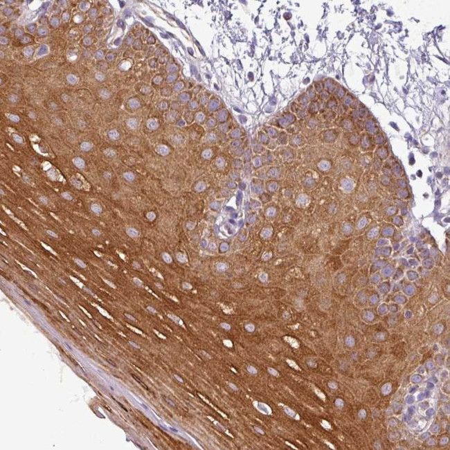 PNMA6A Antibody in Immunohistochemistry (Paraffin) (IHC (P))