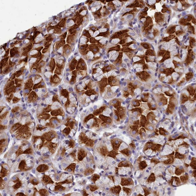 TTC5 Antibody in Immunohistochemistry (Paraffin) (IHC (P))