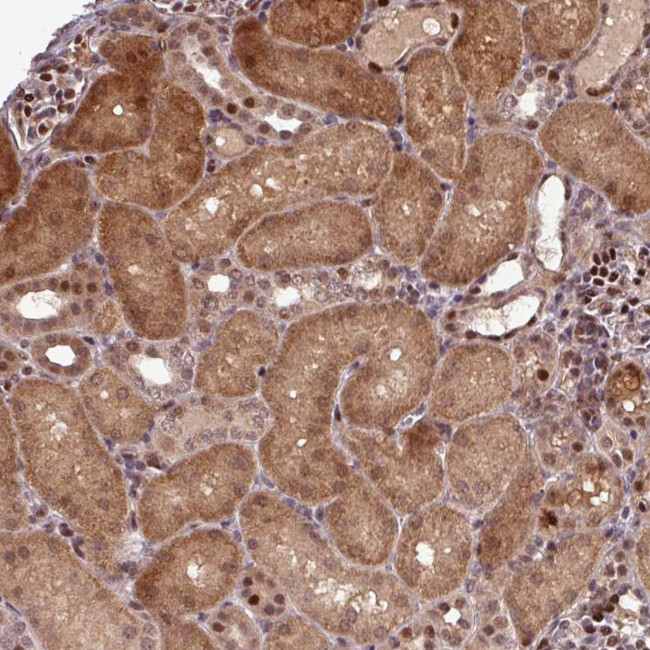 SLC22A24 Antibody in Immunohistochemistry (Paraffin) (IHC (P))