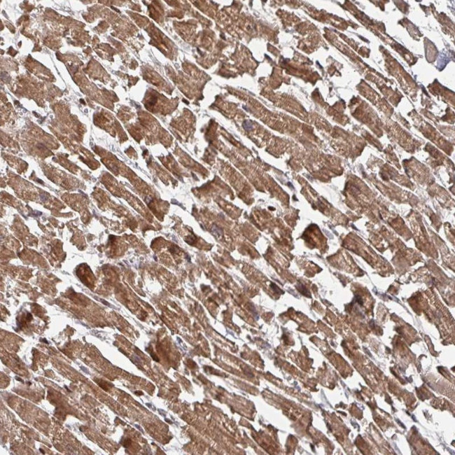 KIF1C Antibody in Immunohistochemistry (IHC)