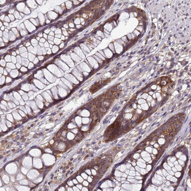 ANKRD17 Antibody in Immunohistochemistry (Paraffin) (IHC (P))