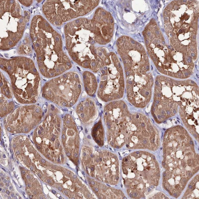 FZD8 Antibody in Immunohistochemistry (Paraffin) (IHC (P))