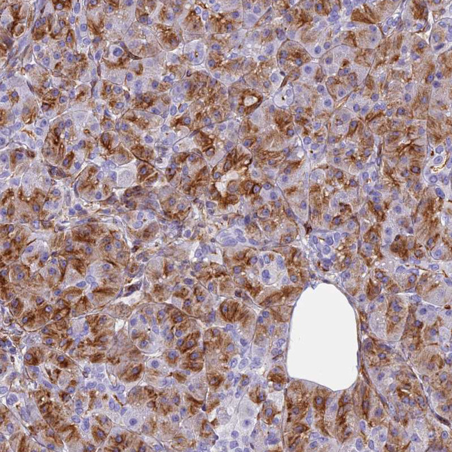 EVI2A Antibody in Immunohistochemistry (Paraffin) (IHC (P))