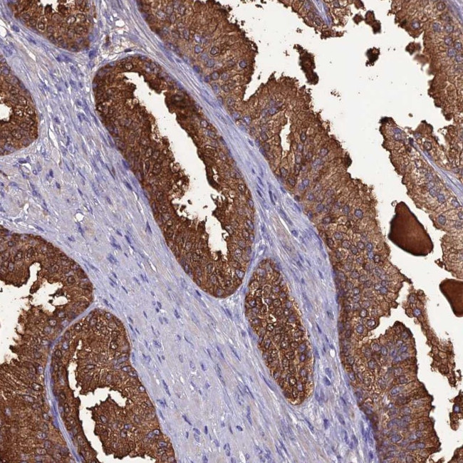 OR56B1 Antibody in Immunohistochemistry (Paraffin) (IHC (P))