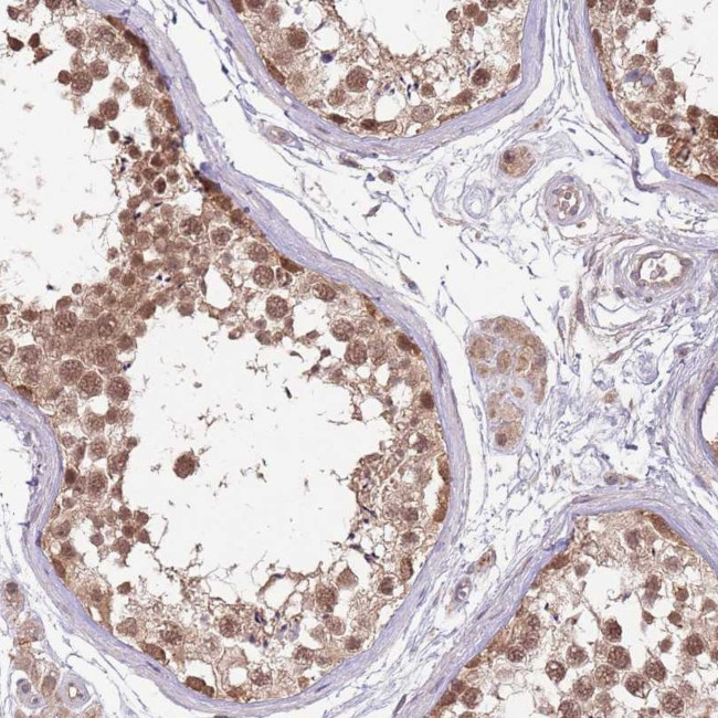 NBPF4 Antibody in Immunohistochemistry (Paraffin) (IHC (P))
