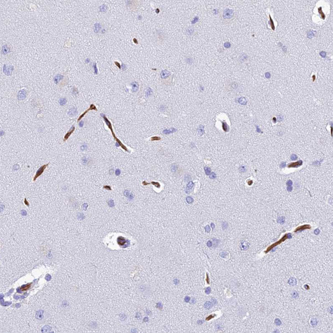 Ninjurin 1 Antibody in Immunohistochemistry (Paraffin) (IHC (P))