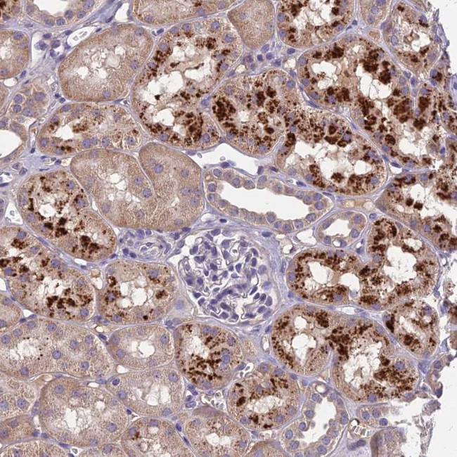 CEACAM16 Antibody in Immunohistochemistry (Paraffin) (IHC (P))
