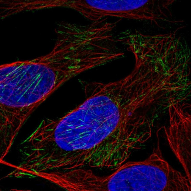 LSM6 Antibody in Immunocytochemistry (ICC/IF)